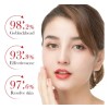 Crema Ácido Salicílico Control Acné Piel Grasa 20g