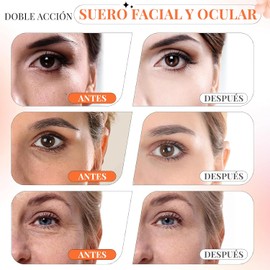 Serum Vitamina C Ácido Hialurónico + Vitamina E Skin Care 95% Ingredientes Naturales Luminosidad,Firmeza y Tono más Uniforme Suero Hidratante,Anti Edad, Anti Manchas,Tonificador y Reafirmante 30ml