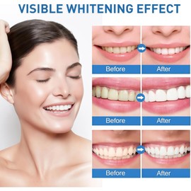 Teeth Whitening Paint,Teeth Tooth Polishing Paste,Whitening Toothpaste,Instant & Long-Lasting Results,Dual Protection