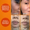 Truskin Vitamin C Serum - Suero Facial Vitamina C