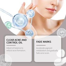 EELHOE Acne Treatment Set Brightening Skin Gentle Moisturizing Repair Moisturizing facial set Skincare Serum acne clearing products Cream  Cleanser