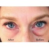 Instant Eye Bag Puffiness And Wrinkle Remover Cream For Women