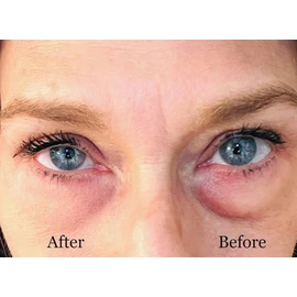 Instant Eye Bag Puffiness And Wrinkle Remover Cream For Women And Men Made In The USA! Cruelty-Free Larger Size