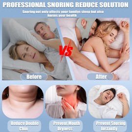 Anti Snore Chin Strap, 2 Pack High Elasticity Traceless Chin Strap for Sleeping, Effective Anti Snoring Device with Earplugs, Snore Stopper Breathable and Stable for Adult
