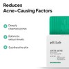 Jabón Exfoliante Corporal Para Rostro, Pecho Y Espalda, Para Piel