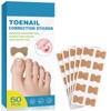 50 Piezas de Parche para Uñas Encarnadas – Soporte Natural