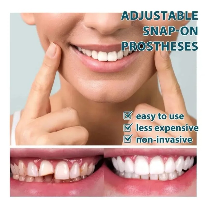 1 Par Carillas Postiza Restauradora Dientes Postizos Sonrisa
