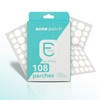 108 Parches para Acné con Hidrocoloide – Everglow Skin Solutions
