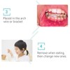 Chargenyang 6 Boxes Dental Oral Care Orthodontics Wax with Fruit