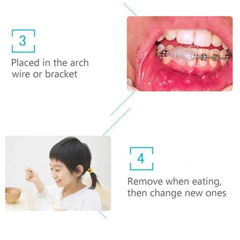 Chargenyang 6 Boxes Dental Oral Care Orthodontics Wax with Fruit