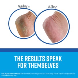 O'Keeffe's K0320001-10 Healthy Feet Foot Cream in Jar (10 Pack), 3.2 oz