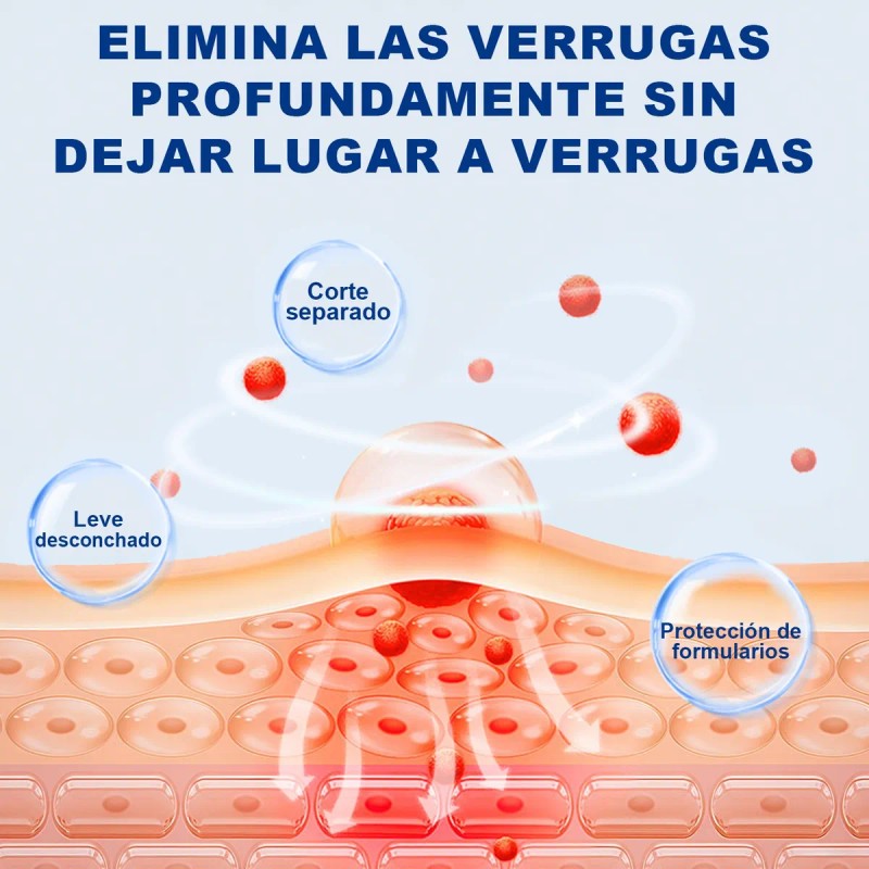 Crema Para Verrugas Elimina Eficazmente Y Cuida La Piel 20g