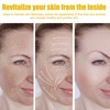 Krmspe Bee Venom Cream, Bee Venom Face Lift Cream for