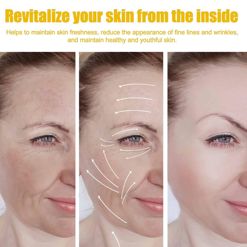 Krmspe Bee Venom Cream, Bee Venom Face Lift Cream for