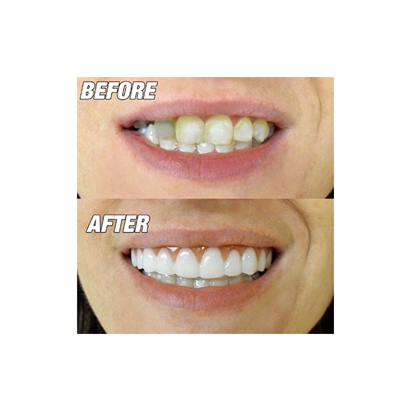 Instant Smile Comfort Fit Flex-Slightly Imperfect Available in Natural White