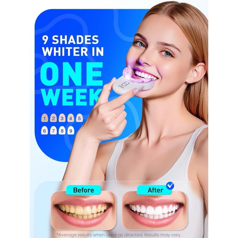 OLLM Teeth Whitening Kit for Sensitive Tooth: Professional Gel 01_white