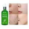Kit Facial Romero Y Centella Asiática Antiacné, Depura 4 Pzs