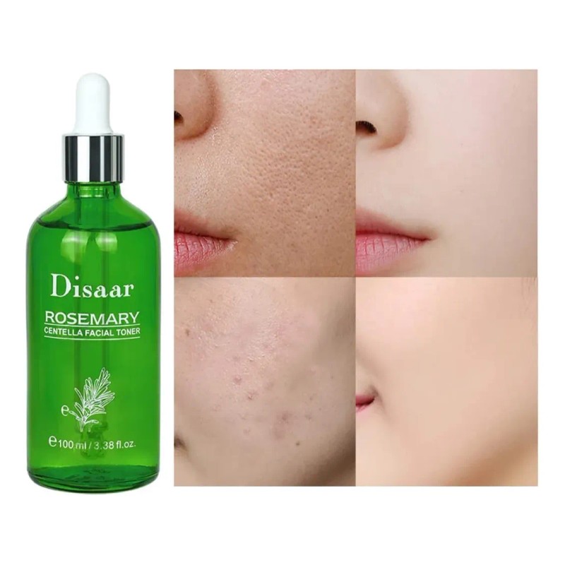 Kit Facial Romero Y Centella Asiática Antiacné, Depura 4 Pzs