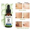 Suero Facial Retinol 2.5% Con Acido Hialuronico 30ml