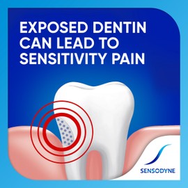 Sensodyne Extra Whitening Toothpaste for Sensitive Teeth, Cavity Prevention and Sensitive Teeth Whitening - 4 Ounces (Pack of 2)