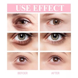 Novensa Retinol Eye Stick Crema De Ojos Antienvejecimiento Retinol