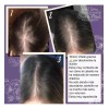 Tónico Vittale Anticaída Crecimiento Restaura Cabello Paso 1