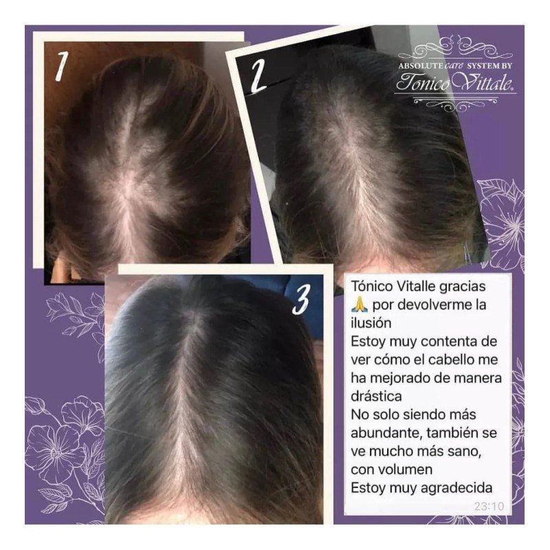 Tónico Vittale Anticaída Crecimiento Restaura Cabello Paso 1