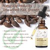 Cyperus Rotundus Oil for Hair Removal Care, 2 Pack, Helps