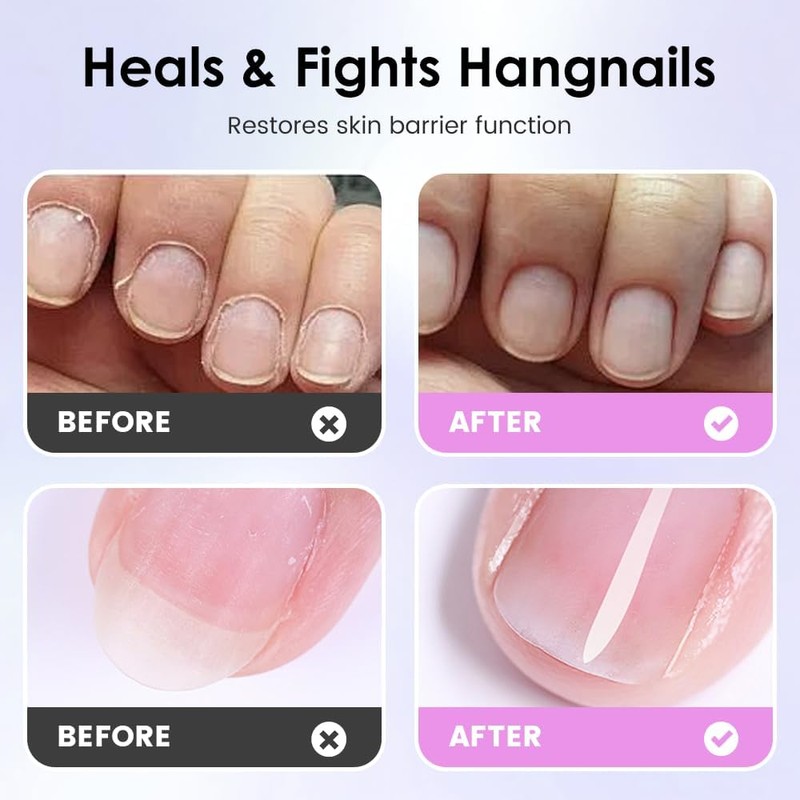2en1 Empujador de Cutículas y Aceite para Cutículas,Herramienta de Manicura