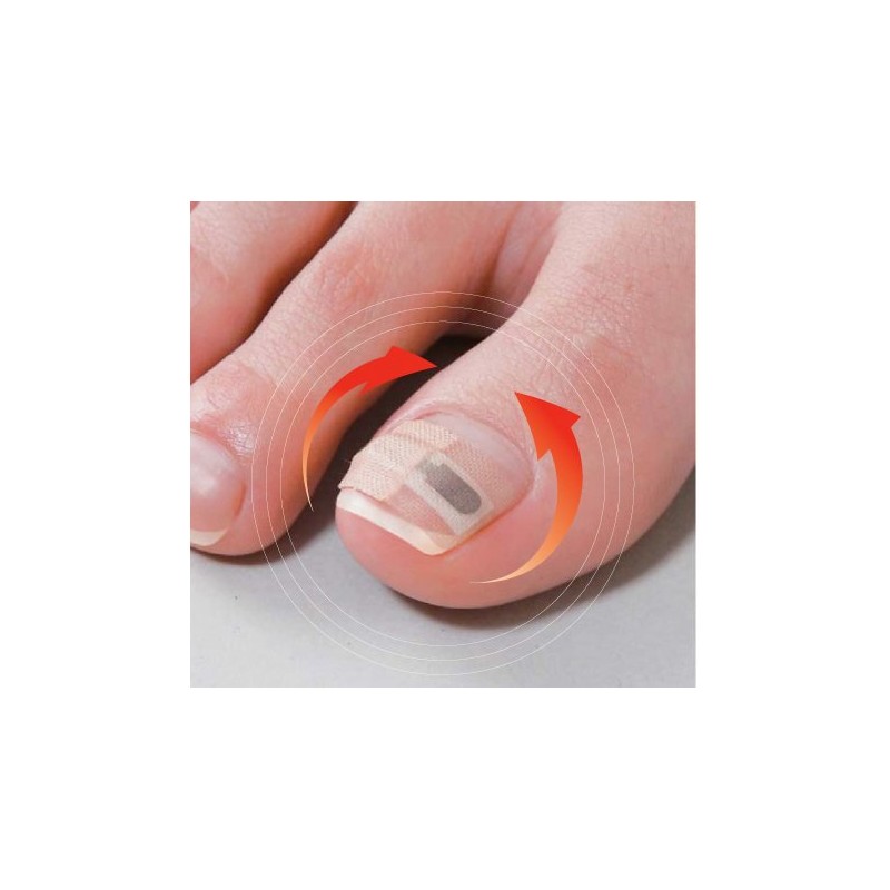 8-4134-01 Roll Up Nail Lift Seal, 1 Month Care, 8