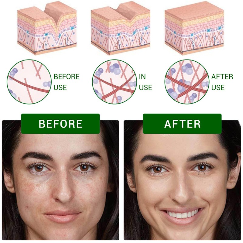 Dark Spot Correcting Glow Serum, Dark Spot Remover for Face