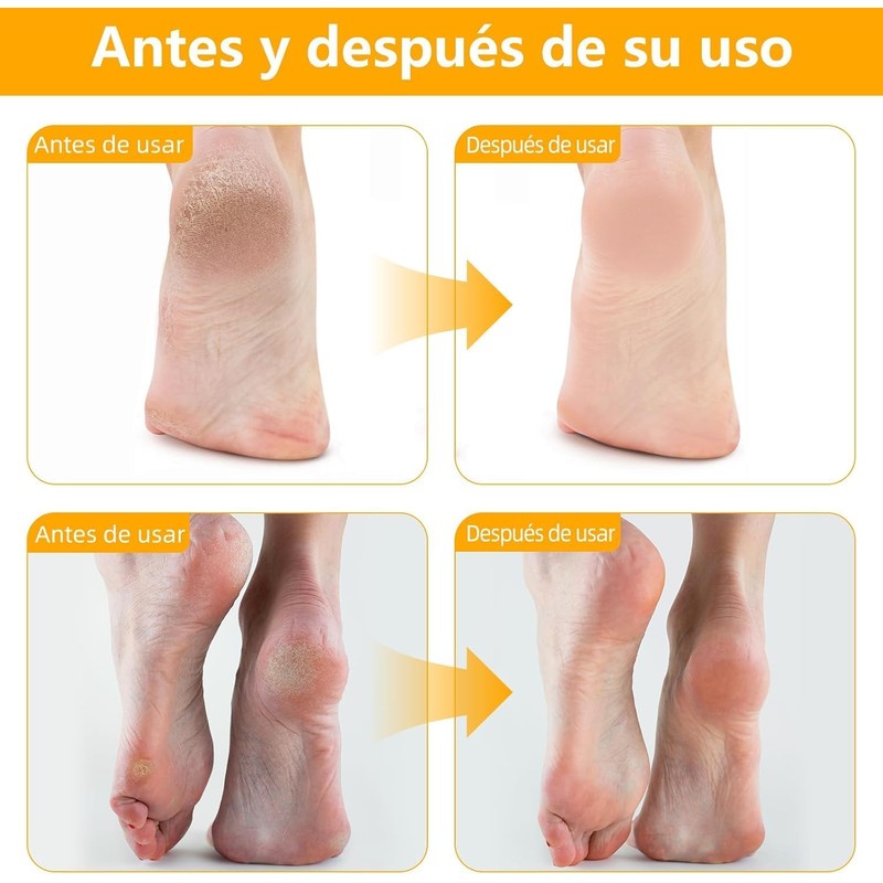 2pcs Crema con Urea 60 para Pies, Hidratante Pies Resecos