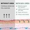 60% Urea Cream Maximum Strength, 10.1 oz - Foot &