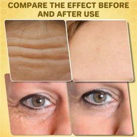 BeeLift Anti-Aging Firming Cream, Bee Venom Skin Firming Wrinkle Reducing Cream, Rejuvenating for All Skin Types