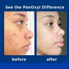 Panoxyl Acné Foaming Wash 10% Peróxido De Benzoilo 156 G