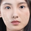 심부볼리프팅 팔자주름 리프터 교정기 안면거상밴드 불독살리프팅 Deep Volumizing Lifting Nasolabial