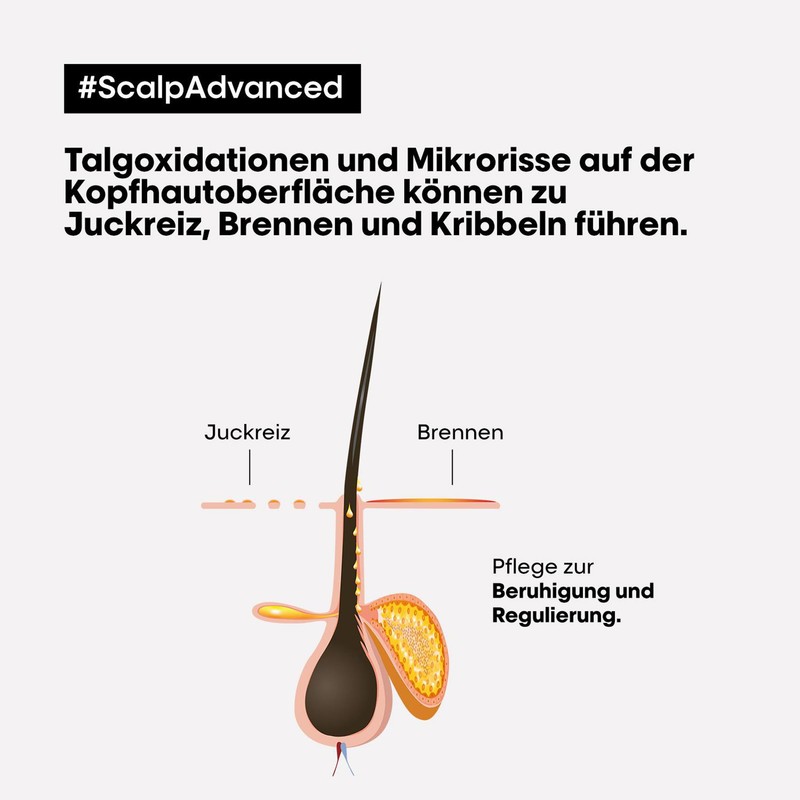 L'Oréal Professionnel Scalp Advanced Anti-Discomfort Intense Soother Treatment 200ml