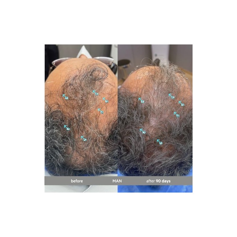 Spectral.DNC-S® | Tratamiento - Serúm Capilar Matizador de Canas