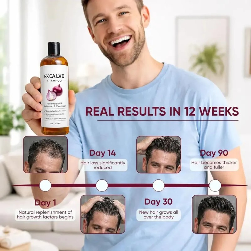 @ Shampoo Excalvo Para Hombres, Con Aceite De Romero, 200