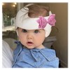 3 Pack Bows for Cranial Helmet Bow Patch Cranial Band
