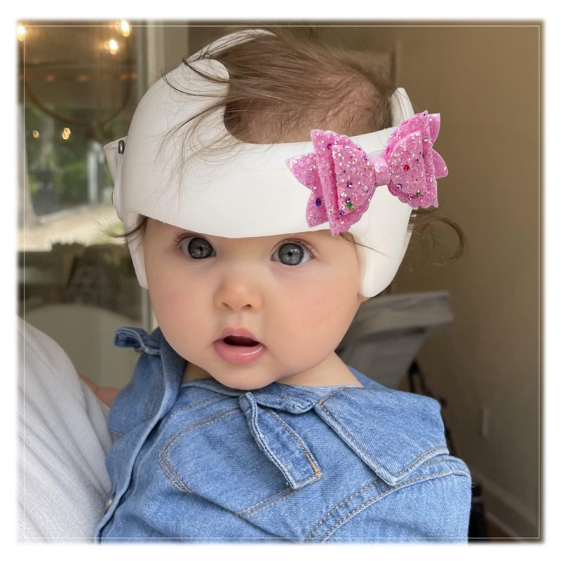 3 Pack Bows for Cranial Helmet Bow Patch Cranial Band