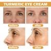 Turmeric Eye Cream for Under Eye Bags - Eye Care