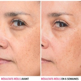 It Cosmetics Bye bye lines, Serum, Suero con Ácido Hialurónico, Reafirma Visiblemente la Piel y Suaviza las Líneas en 2 Semanas, Con Péptido + Vitamina B5, 30 ml