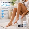 Electric Foot File for Smooth Heel Care – Rechargeable Callus