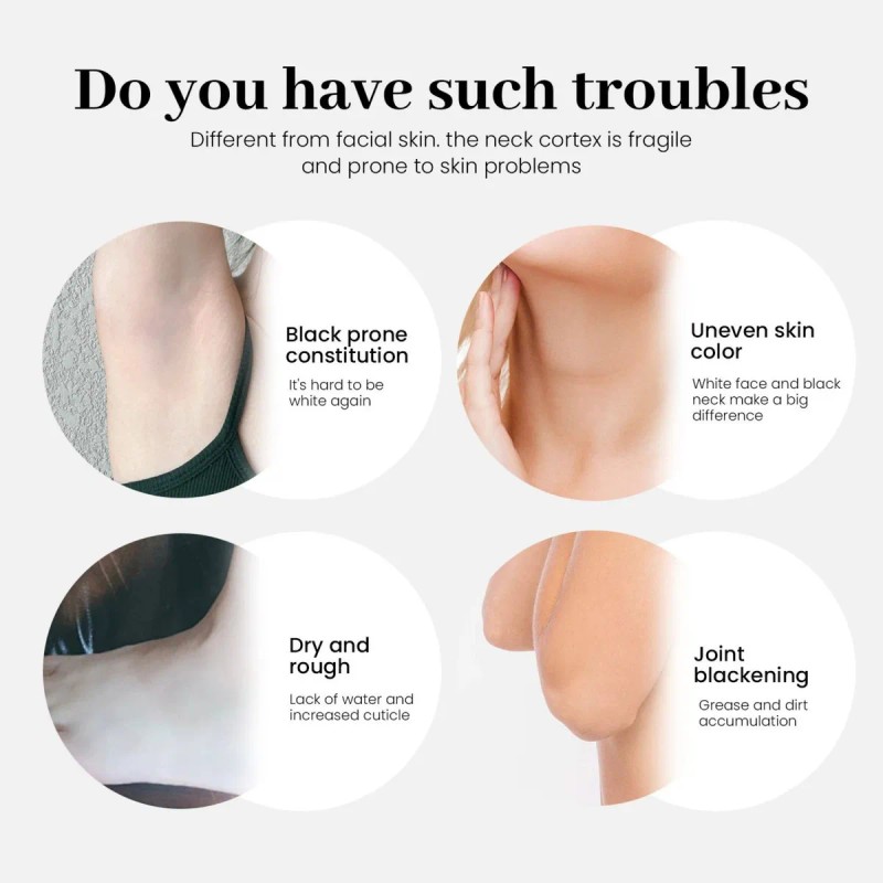 Crema Especial Para Axilas, 30 Ml, Desodorante Kójico Y Anti