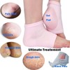 Codream Vented Moisturizing Socks Lotion Gel for Dry Cracked Heels,