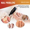 32 PATCHES Fungal Nail Patches - Nail Fungus for Toenail