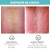 Set de 4 Limpiador de Lengua, Raspador de Lengua Reutilizable