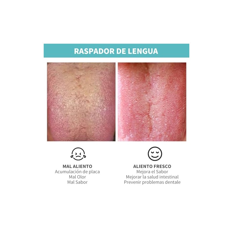 Set de 4 Limpiador de Lengua, Raspador de Lengua Reutilizable