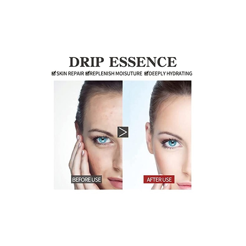 Eelhoe Eternity Vitamin C Serum Dark Spot Corrector, Esencia de